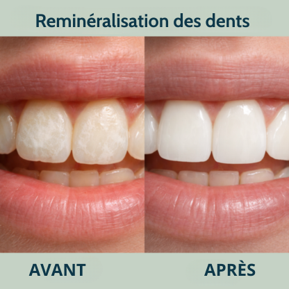 Chewing-gum reminéralisant