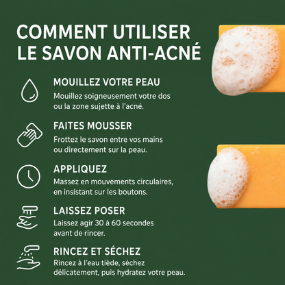 Savon anti acné