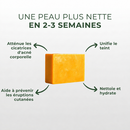 Savon anti acné