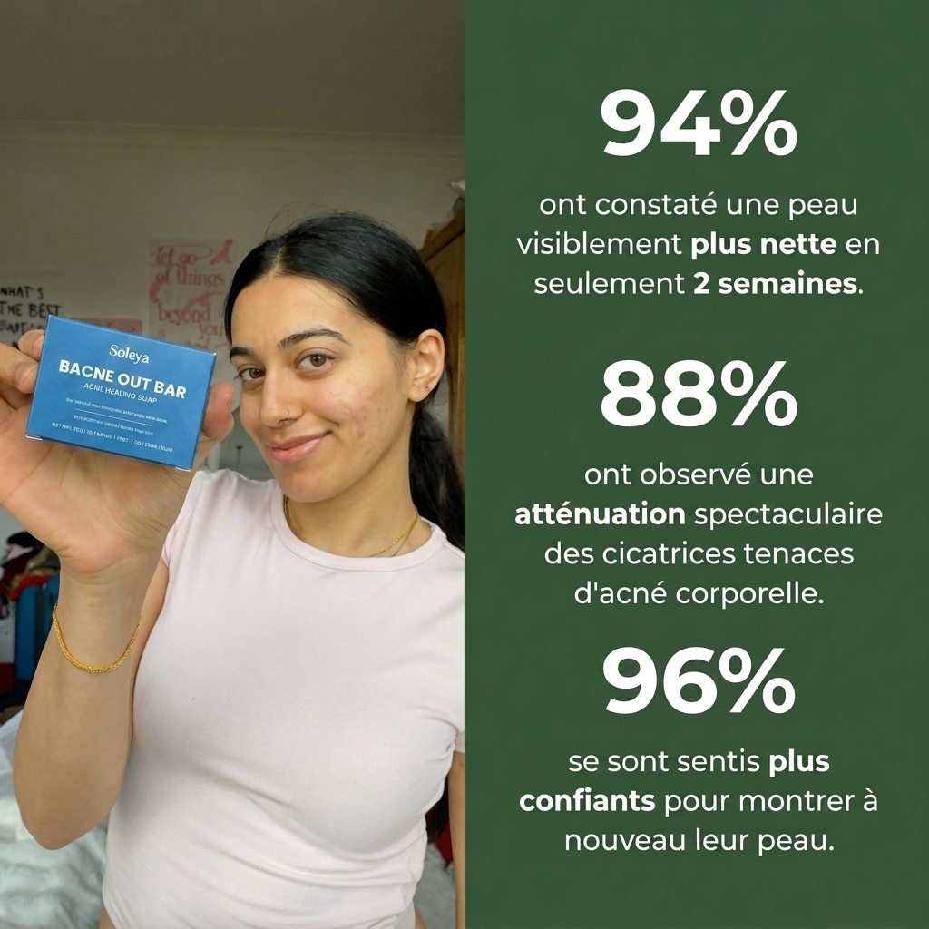 Savon anti acné