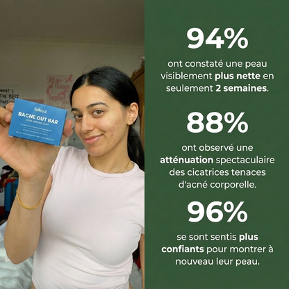 Savon anti acné