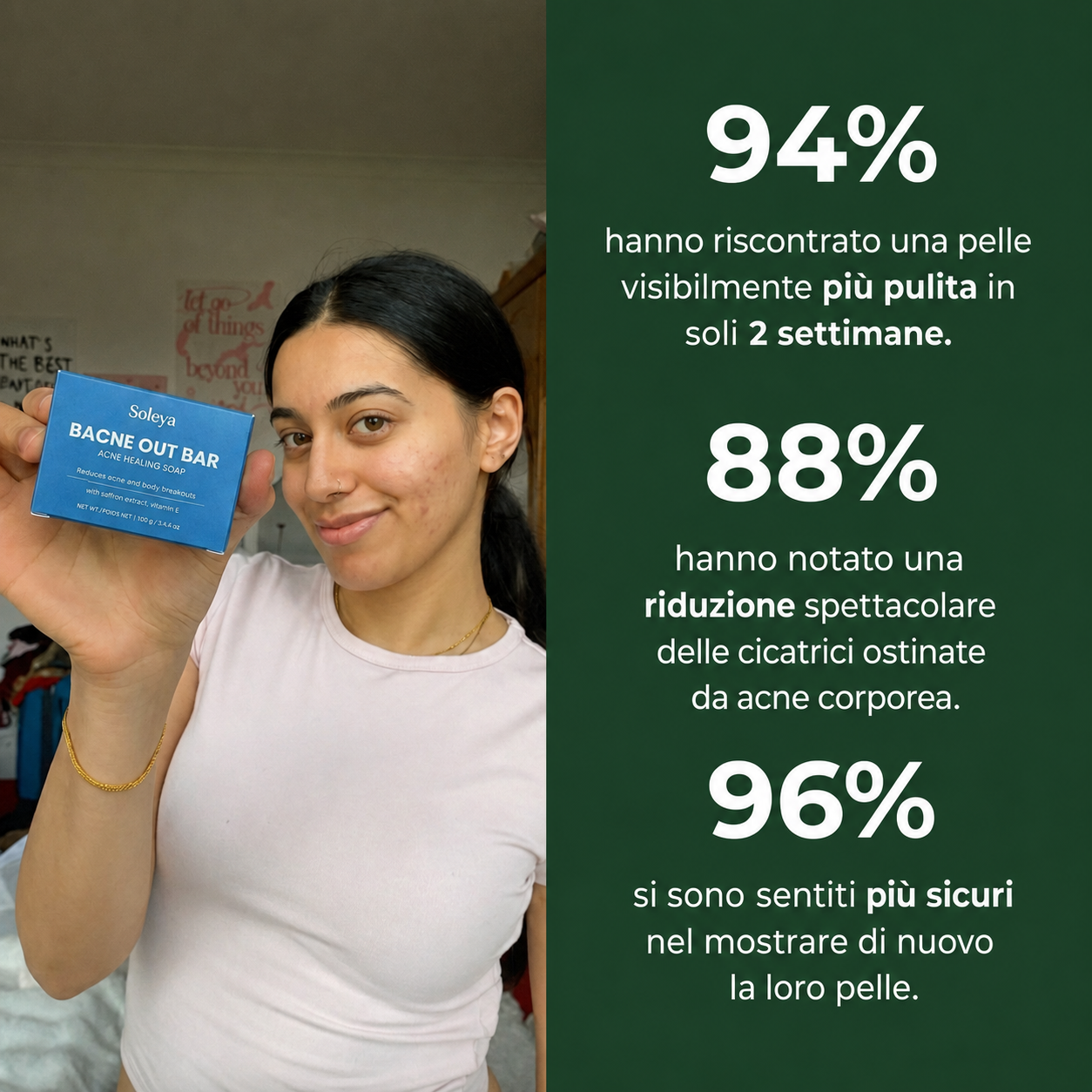 Sapone anti-acne Soleya - statistiche di efficacia