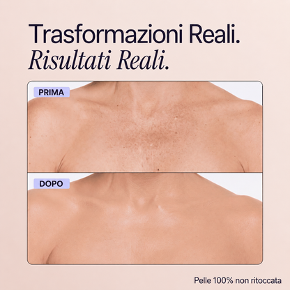 Trasformazioni reali - Perfezionatore Pelle Perfetta
