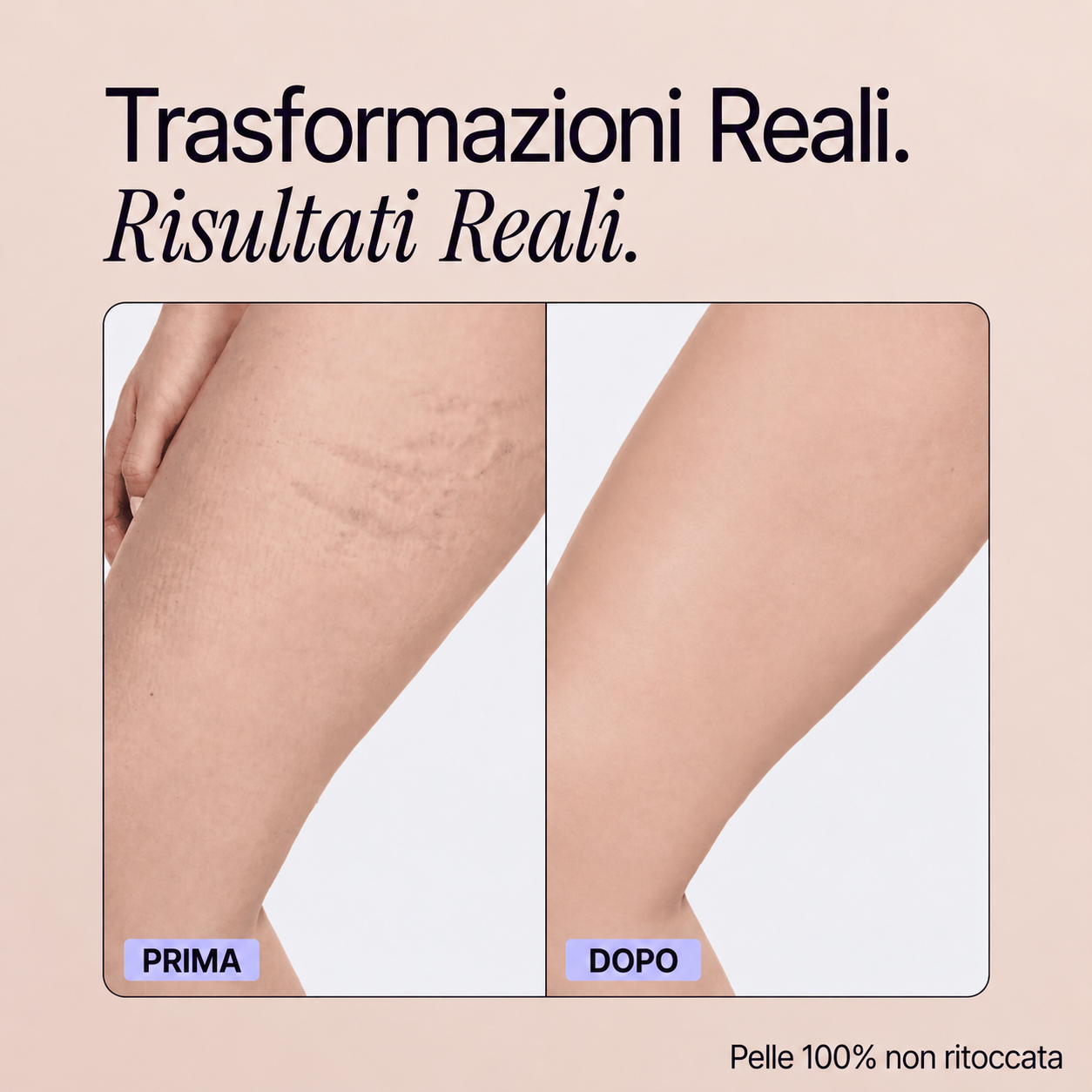 Trasformazioni reali - Perfezionatore Pelle Perfetta
