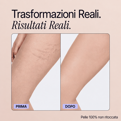 Trasformazioni reali - Perfezionatore Pelle Perfetta