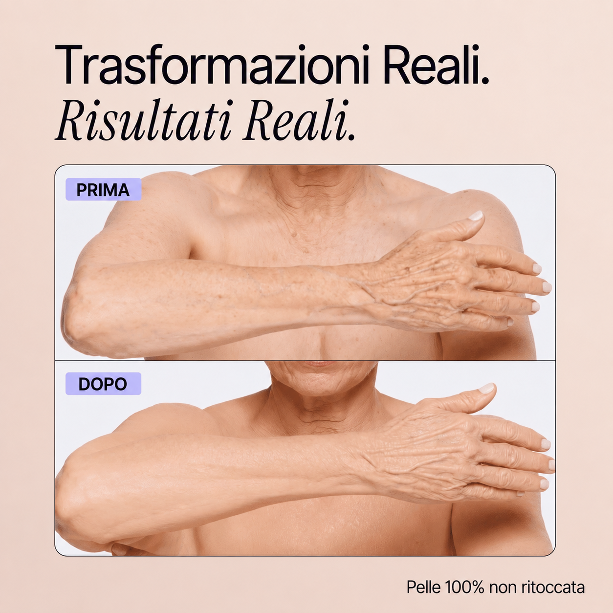 Trasformazioni reali - Perfezionatore Pelle Perfetta