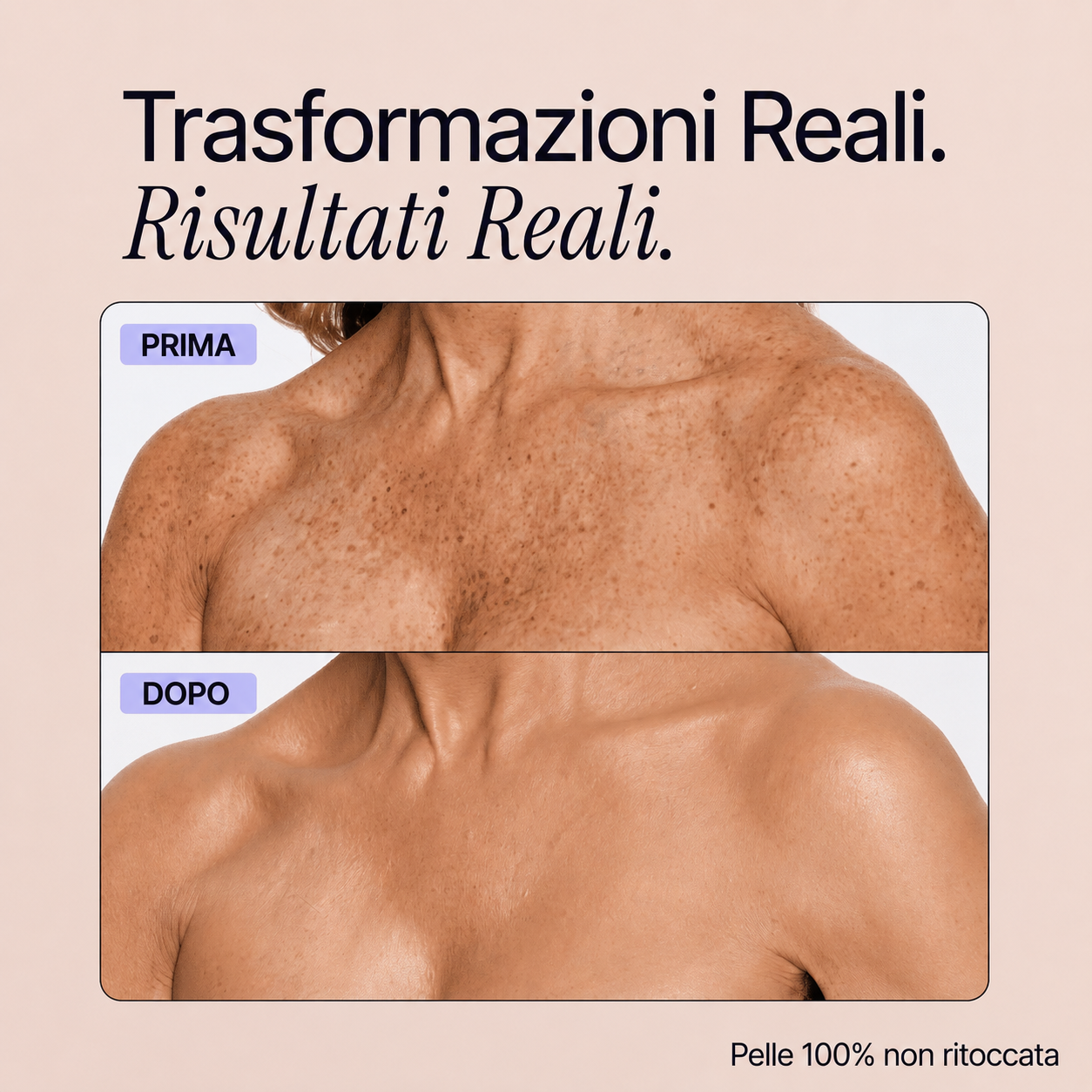 Trasformazioni reali - Perfezionatore Pelle Perfetta