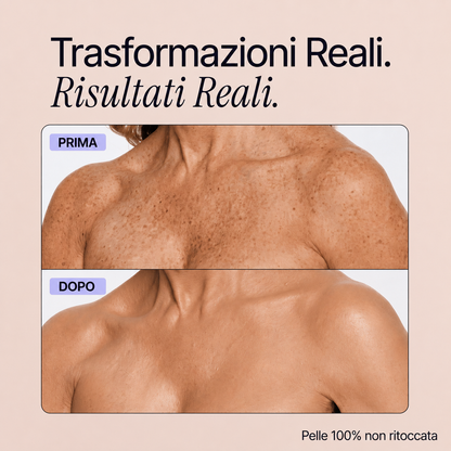 Trasformazioni reali - Perfezionatore Pelle Perfetta