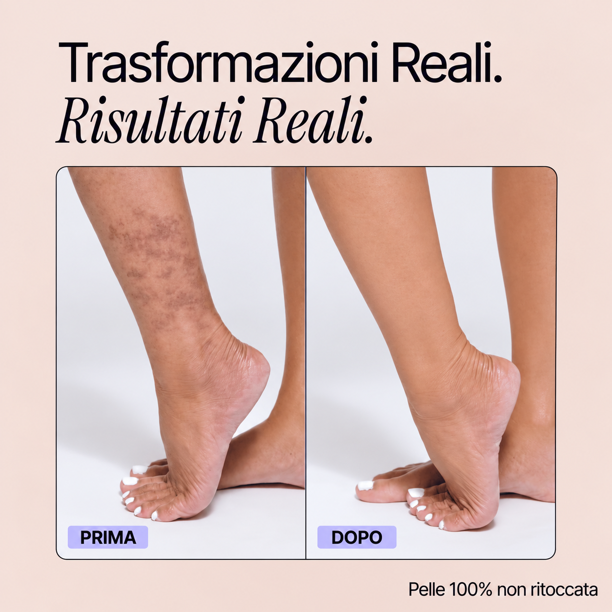 Trasformazioni reali - Perfezionatore Pelle Perfetta