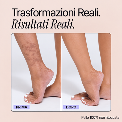 Trasformazioni reali - Perfezionatore Pelle Perfetta