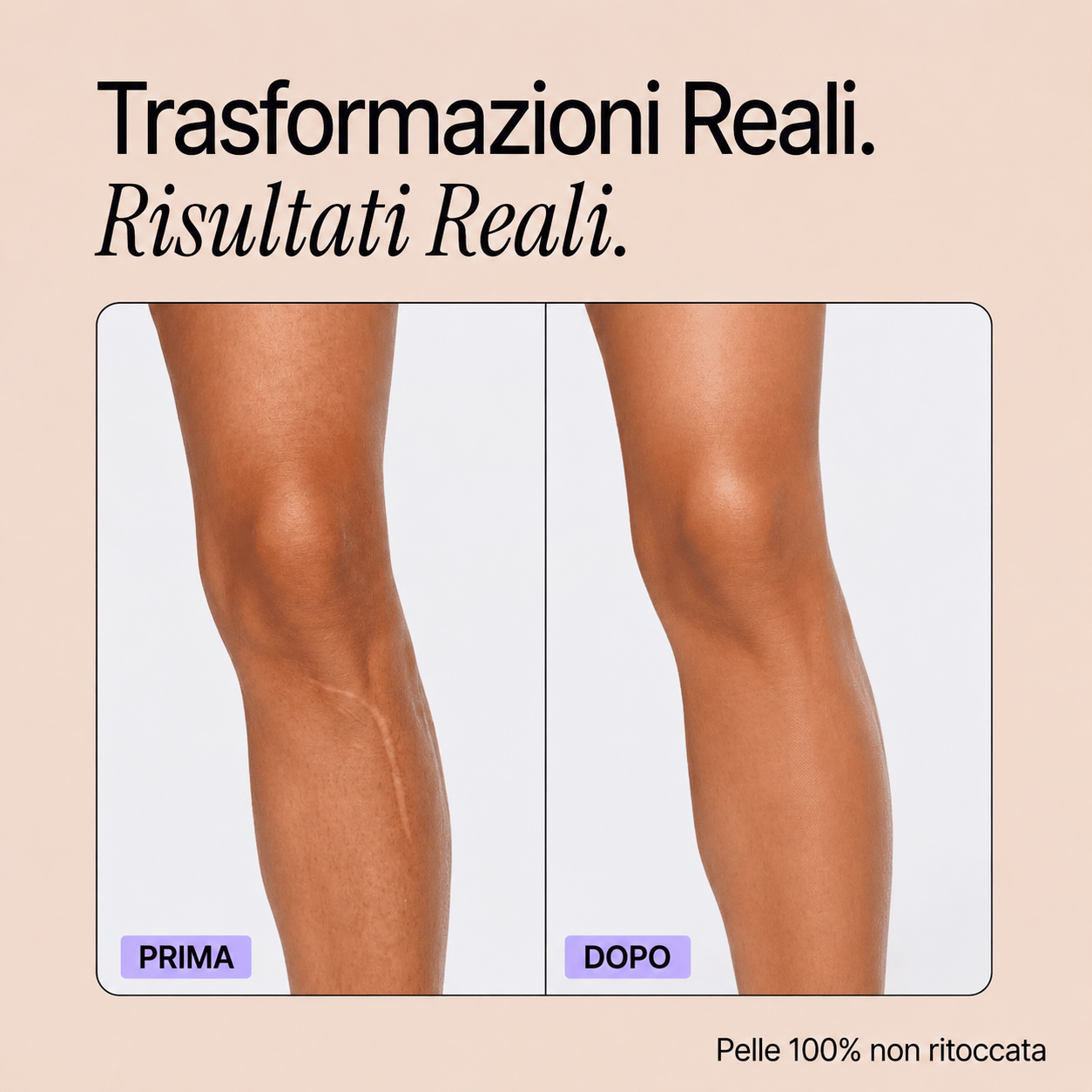 Trasformazioni reali - Perfezionatore Pelle Perfetta