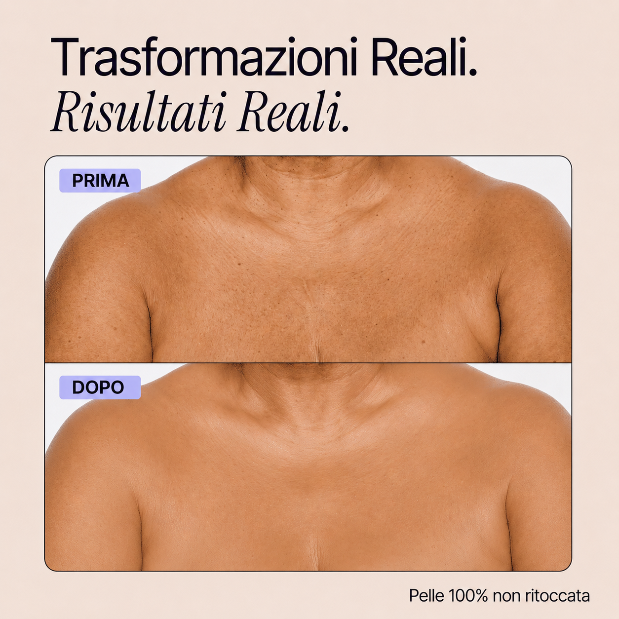 Trasformazioni reali - Perfezionatore Pelle Perfetta