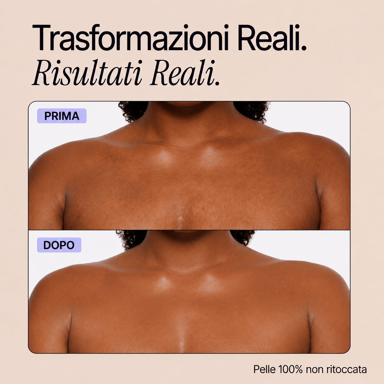 Trasformazioni reali - Perfezionatore Pelle Perfetta