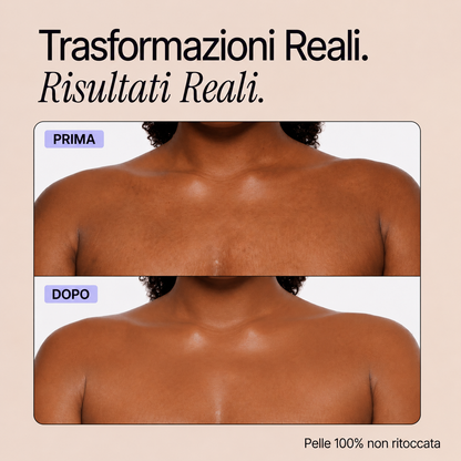 Trasformazioni reali - Perfezionatore Pelle Perfetta