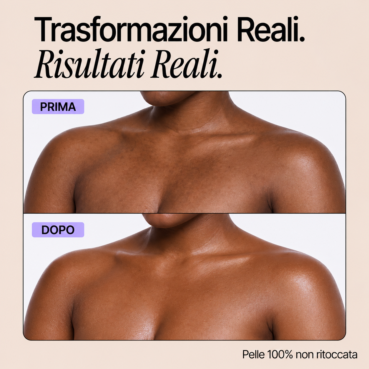 Trasformazioni reali - Perfezionatore Pelle Perfetta