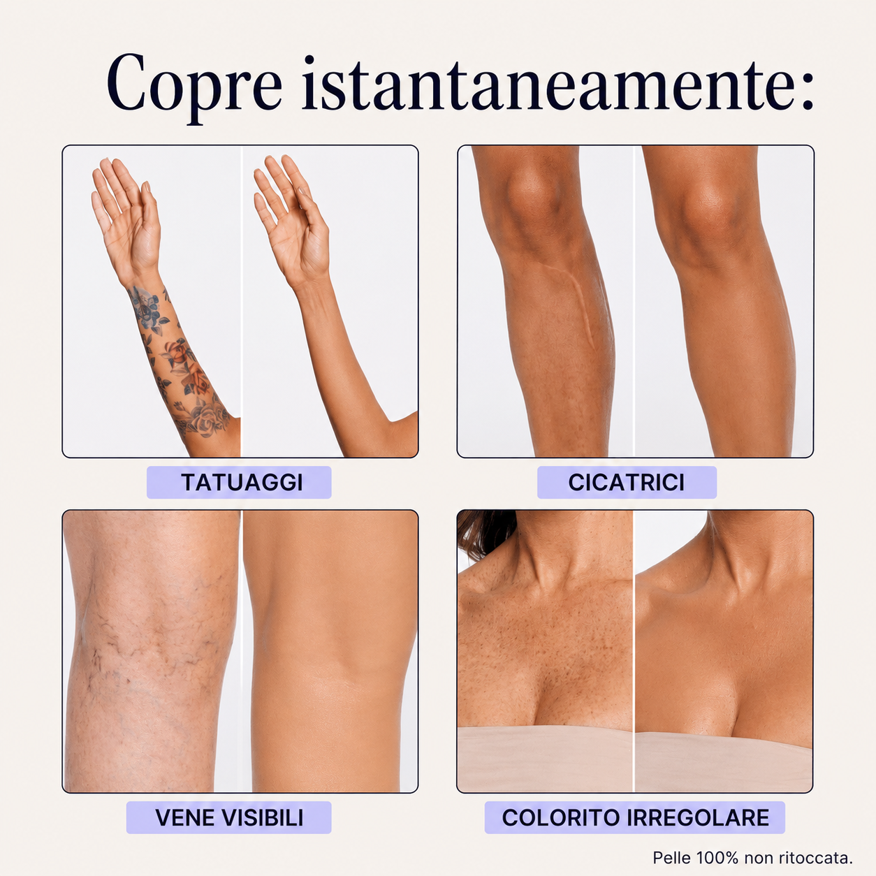 Perfezionatore Pelle Perfetta Soleya
